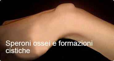 HONDRO SOL ACQUISTARE